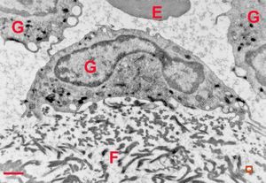 clotted blood - fibrin and granulocytes clotted blood - fibrin and granulocytes